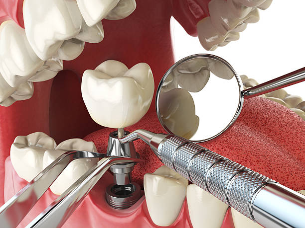 Best Cosmetic Emergency Dentistry in Edwardsvle, IL